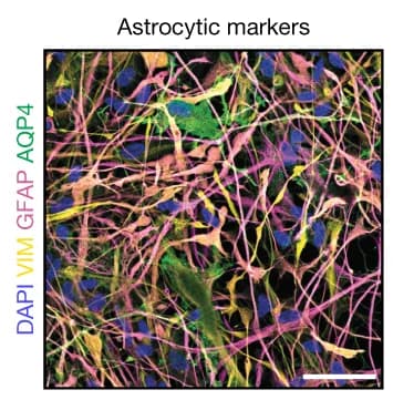 Open access visualization of Microscopy, Immunofluorescence, Neural Cultures, Astrocytic Markers