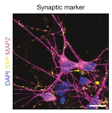 Open access visualization of Microscopy, Synaptic Marker, Immunofluorescence, SYP
