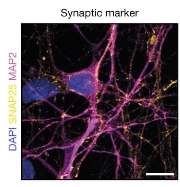 Open access visualization of Microscopy, Synaptic Marker, Immunofluorescence, SNAP-25