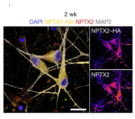 Open access visualization of Microscopy, HA-tag, NPTX2, Immunofluorescence, iNet Neurons