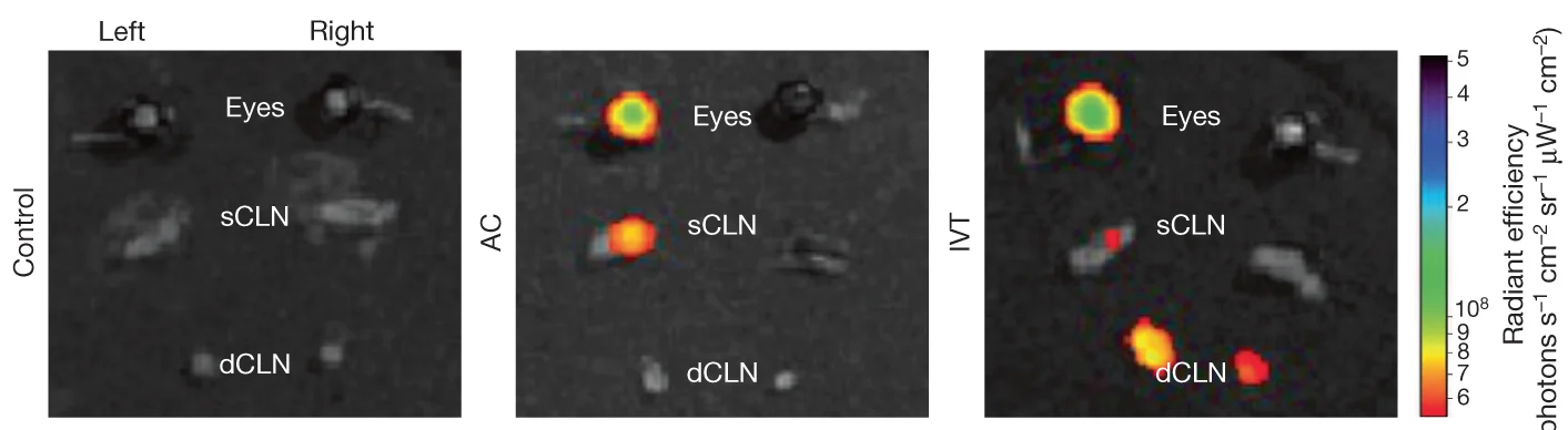 Open access visualization of Microscopy, Dye, AC Injection, IVT Injection, Eye