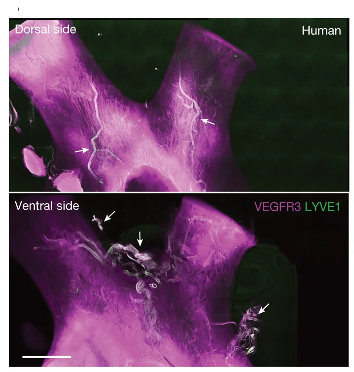 Open access visualization of Microscopy, Immunostaining, Optic Nerve, Zebrafish, Lymphatics