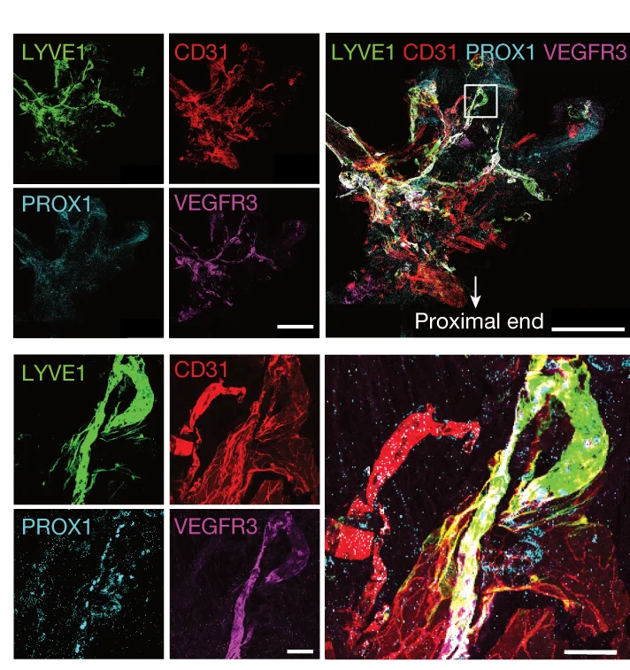 Open access visualization of Microscopy, Whole-Mount, Wild-Type Mouse, Optic Nerve Sheaths, LYVE1