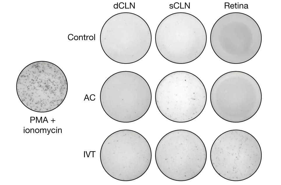 Open access visualization of Microscopy, rAAV-RFP, IVT, AC route, dCLNs