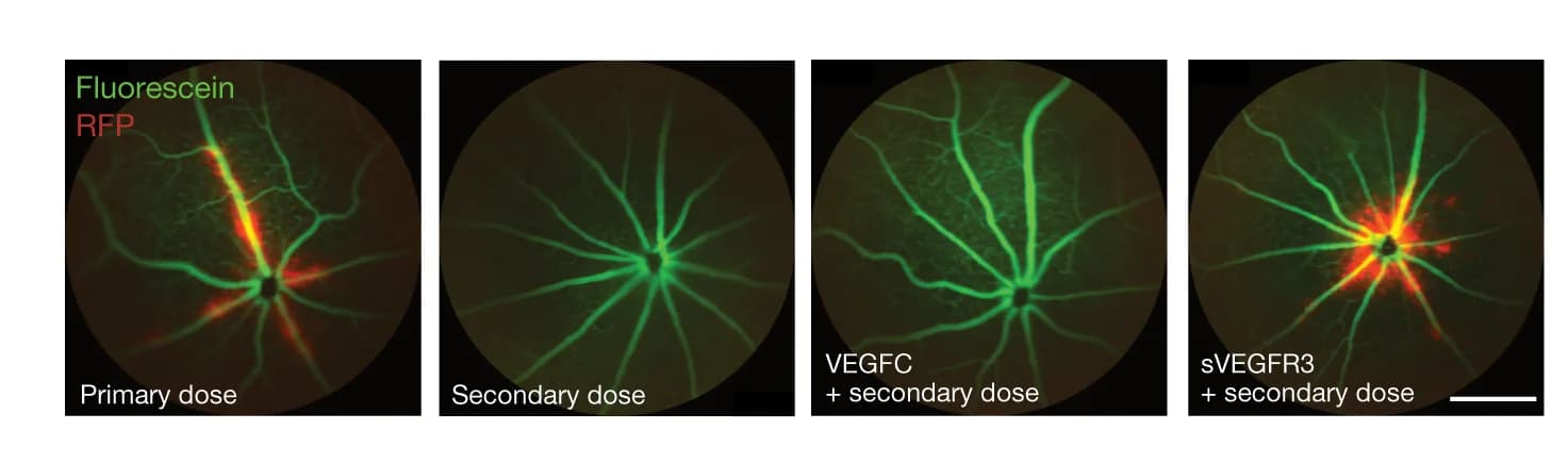 Open access visualization of Microscopy, In Vivo Fluorescence Fundus Imaging, Vessels, RFP Transduction, VEGFC
