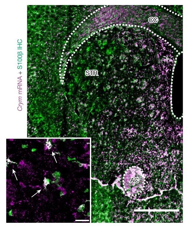 Open access visualization of Microscopy, Crym mRNA, S100 IHC, Corpus callosum, Anterior commissure