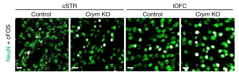 Open access visualization of Microscopy, cFOS, NeuN, Central Striatum, Lateral Orbitofrontal Cortex