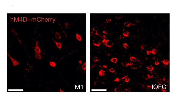 Open access visualization of Microscopy, Neurons, M1, lOFC, rg-hM4Di-mCherry