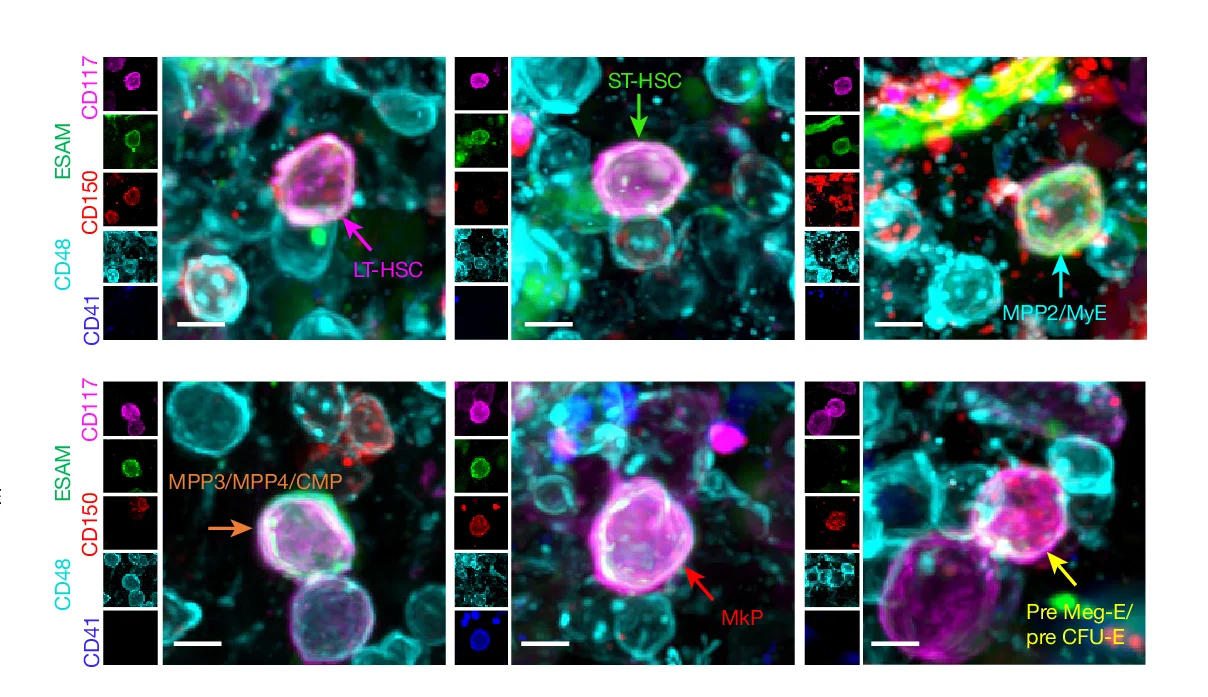 Open access visualization of Microscopy, Representative Images, HSPCs, Sterna, Whole-Mounted