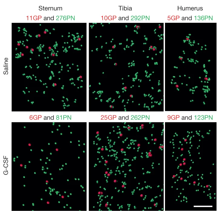 Open access visualization of Scatter Plot, Granulocyte Progenitors, Preneutrophils, Sternum, Tibia