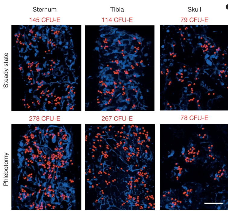 Open access visualization of Microscopy, CFU-Es, Terminal Erythroid Progenitors, Sternum, Tibia
