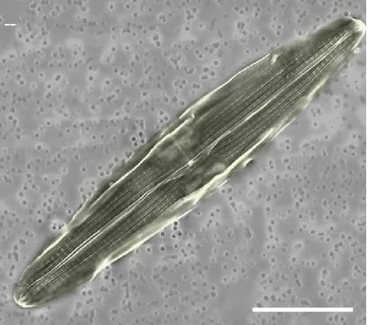 Open access visualization of Microscopy, Scanning Electron Microscopy, SEM, Haslea Diatom, Ca. T. diatomicola