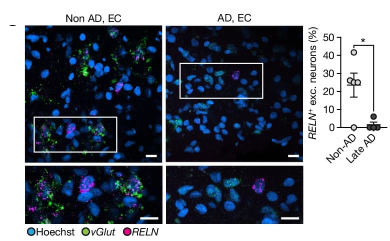 Open access visualization of Microscopy, Scatter Plot, Error Bars, In Situ Hybridization, RNAscope