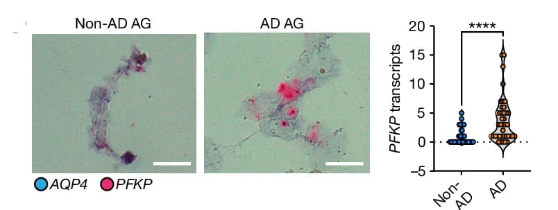 Open access visualization of Violin Plot, Scatter Plot, RNAscope, Astrocytes, Energy Metabolism