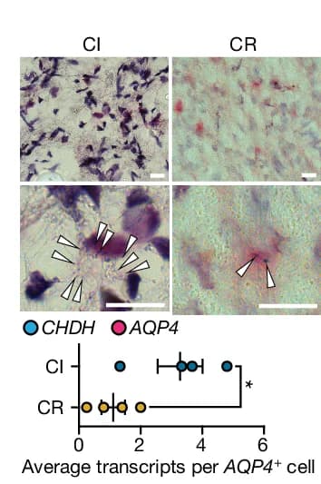 Open access visualization of Scatter Plot, Error Bars, Microscopy, CR Genes, Astrocytes