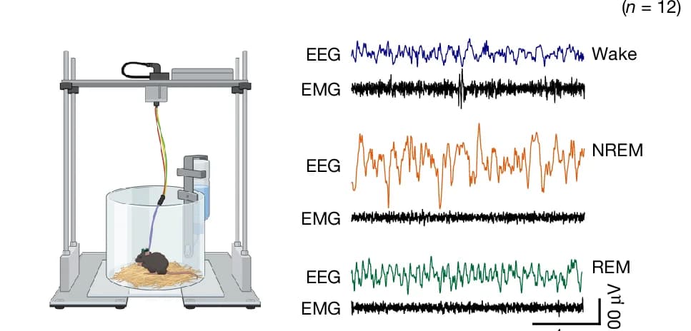 Open access visualization of Line Plot, EEG, EMG, Recording Setup, Schematic