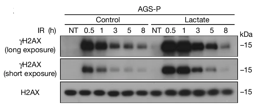 Open access visualization of Gel, AGS-P Cells, Lactate, IR Treatment, Immunoblotting