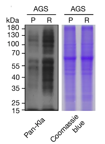 Open access visualization of Gel, AGS-P Cells, AGS-R Cells, Cell Lysates, Immunoblotting