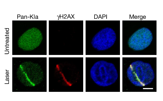 Open access visualization of Microscopy, AGS-P Cells, Laser Microirradiation, Anti-pan-Kla, Anti-H2AX