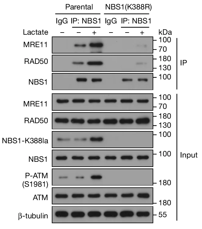 Open access visualization of Gel, AGS-P Cells, AGS-NBS1(K388R) Cells, Lactate, Whole-Cell Extracts