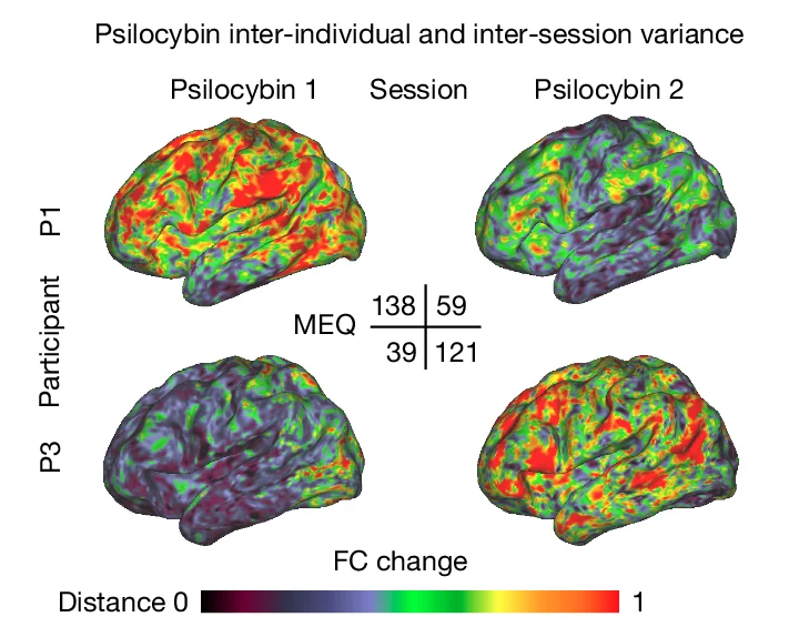 Open access visualization of 3D Plot, Functional Connectivity, MEQ30 Scores, Drug Sessions