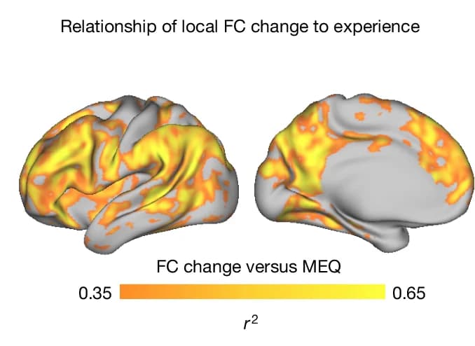 Open access visualization of 3D Plot, Protein Structure, Functional Connectivity, MEQ30, Cortical Surface