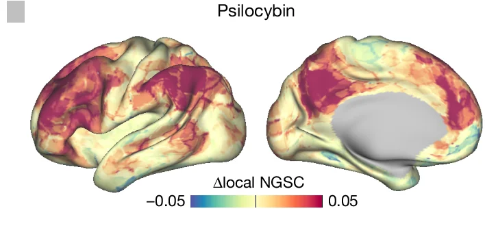Open access visualization of 3D Plot, Spatial Entropy, Cortical Surface, Psilocybin, Association Cortex