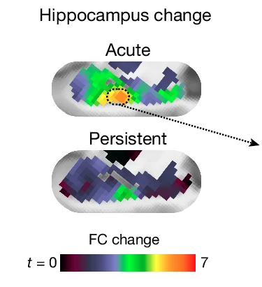 Open access visualization of Heatmap, Hippocampus, FC Change Maps, Psilocybin, Functional Connectivity