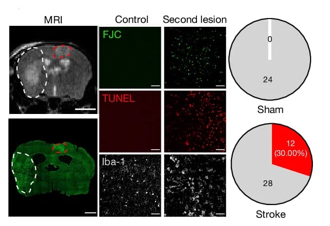 Open access visualization of Microscopy, Pie Chart, MRI Image, Fluoro Jade C Staining, Histological Staining