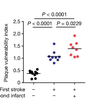 Open access visualization of Scatter Plot, Plaque Vulnerability, CCA Sections, Analysis of Variance