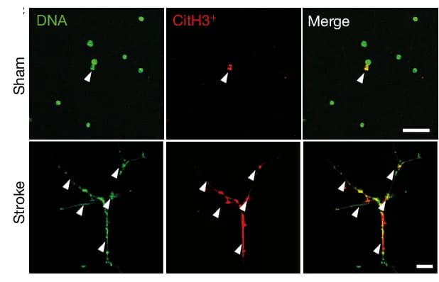 Open access visualization of Microscopy, Microphotographs, Mouse Neutrophils, Sham Serum, Stroke Serum