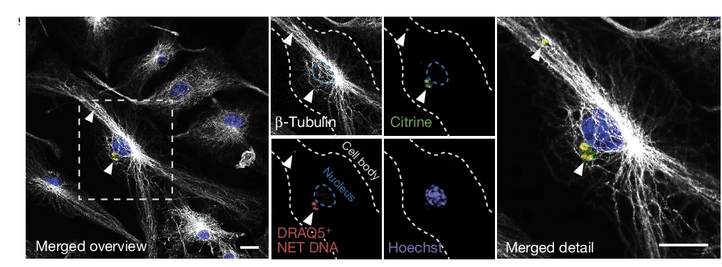Open access visualization of Microscopy, BMDMs, ASC-Citrine Reporter Mice, DRAQ5-Labelled NET-DNA, Immunohistochemistry