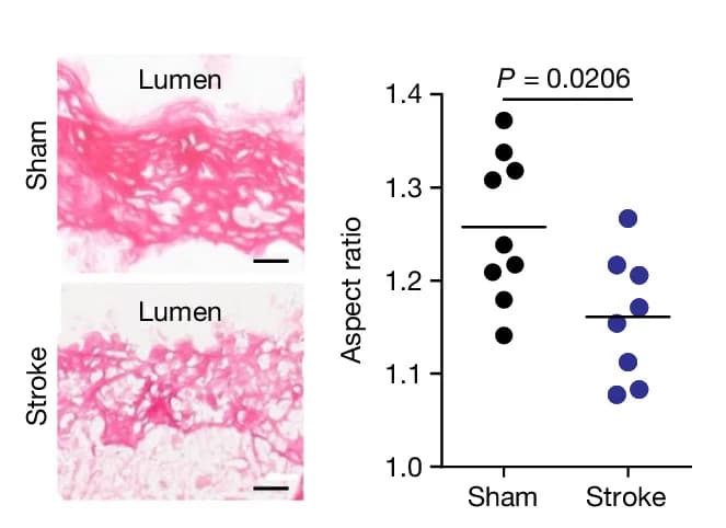 Open access visualization of Scatter Plot, Microscopy, Collagen I, Fibrous Caps, Aspect Ratio