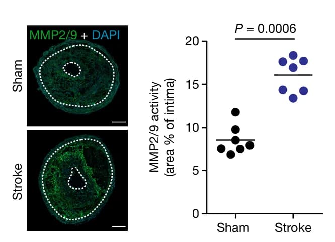 Open access visualization of Scatter Plot, Microscopy, MMP2/9 Activity, In Situ Zymography, CCA Sections
