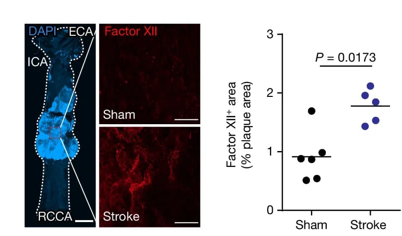 Open access visualization of Scatter Plot, CCA, En Face Immunohistology, Factor XII, Sham