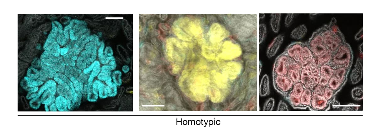 Open access visualization of Microscopy, Confocal Micrographs, Homotypic Tumors