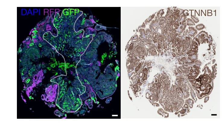 Open access visualization of Microscopy, Immunofluorescence Staining, GFP, RFP, Beta-Catenin