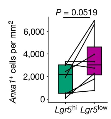 Open access visualization of Box Plot, Scatter Plot, Anxa1, Lgr5, Heterotypic Tumors