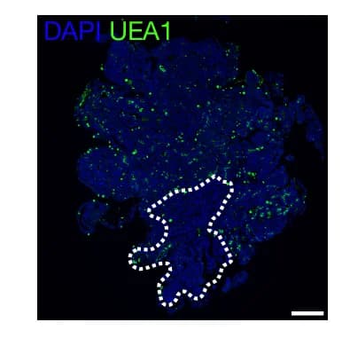 Open access visualization of Microscopy, Serial Sections, Heterotypic Tumor, GFP, RFP