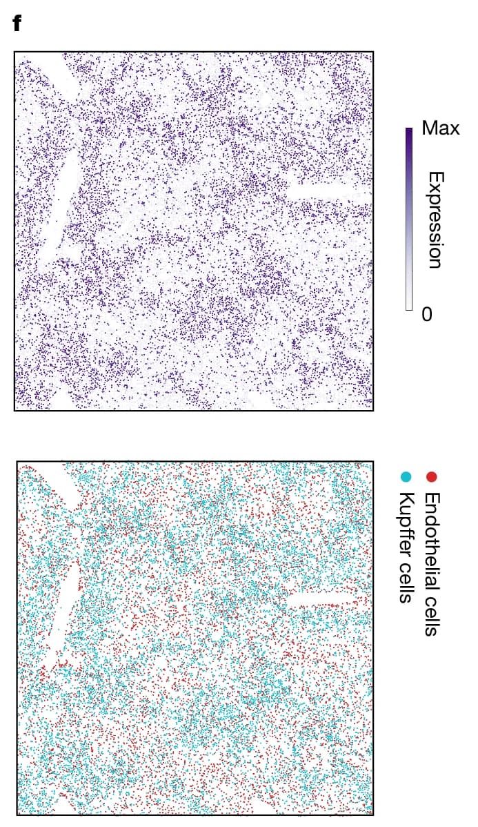 Open access visualization of Scatter Plot, Spatial data, Cell type, Kupffer cells, Endothelial cells