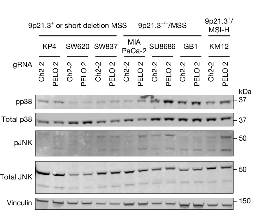 Open access visualization of Gel, Immunoblots, Phospho-p38, Total p38, Phospho-JNK