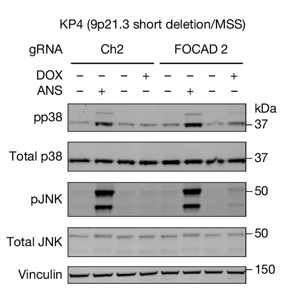 Open access visualization of Gel, Immunoblots, Phospho-p38, Total p38, Phospho-JNK