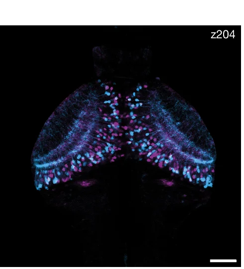 Open access visualization of Microscopy, Confocal Stack, atf5b Transgenic Fish, sp5l Transgenic Fish, Focal Plane