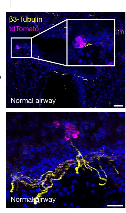 Open access visualization of Microscopy, nAChR Subunit, NE Cell Lines, Non-NE Cell Lines