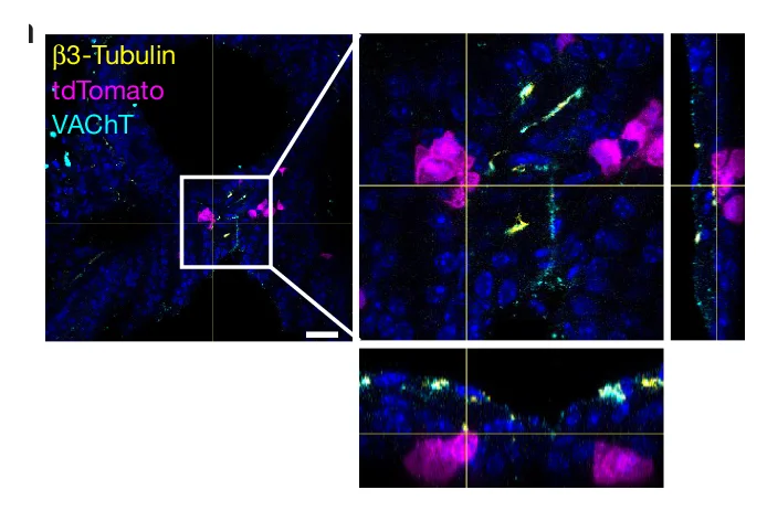 Open access visualization of Microscopy, Orthogonal Projection, Early SCLC, Nuclei, DAPI
