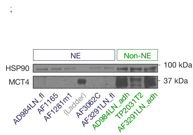 Open access visualization of Gel, Western Blot, MCT4, NE Cell Lines, Non-NE Cell Lines