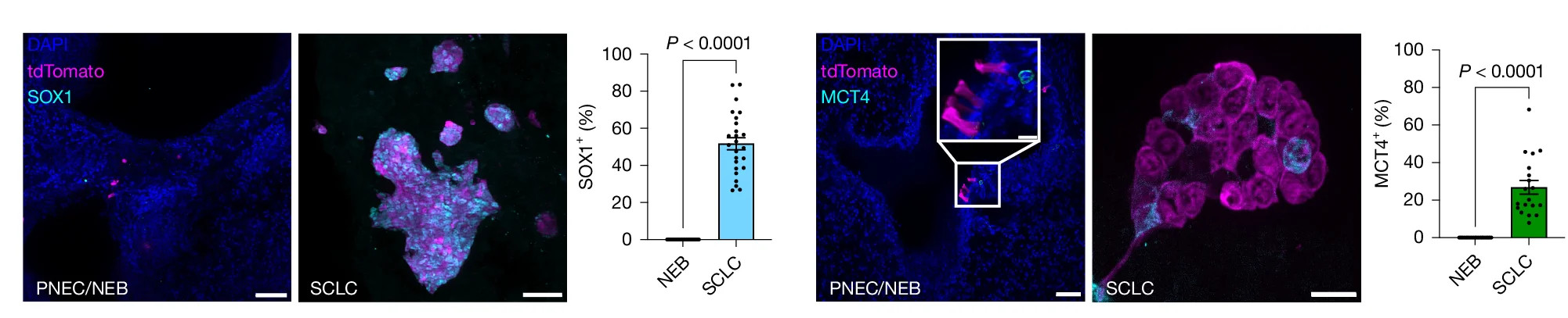 Open access visualization of Microscopy, Bar Plot, Error Bars, SOX1, MCT4