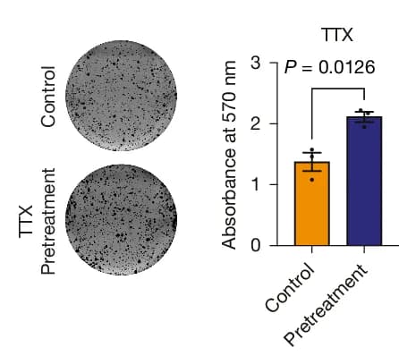 Open access visualization of Bar Plot, Error Bars, Photo, Colony Formation, NE Cells