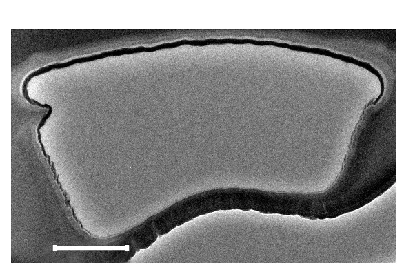 Open access visualization of Microscopy, Transmission Electron Microscopy, TEM, Device, Cross-Section