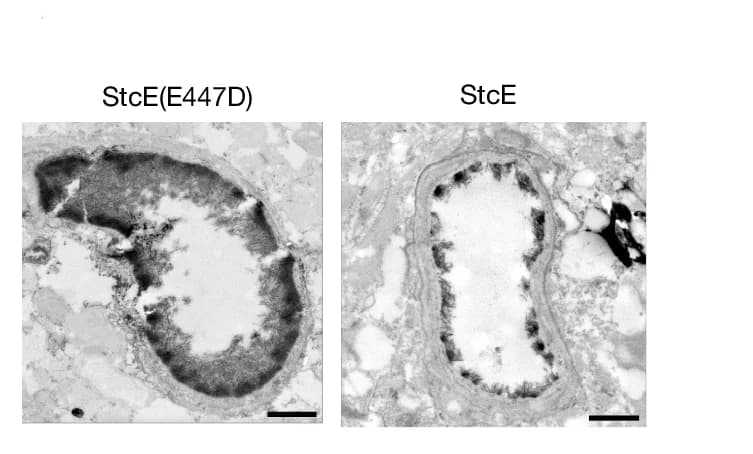 Open access visualization of Microscopy, TEM, Cortical Capillaries, Lanthanum Nitrate, Mice